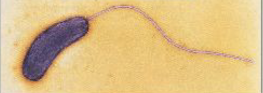 <p>What type of Flagella arrangement is this?</p>