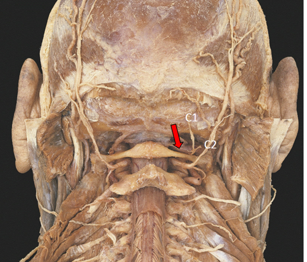 <p>What is the red arrow showing?</p>