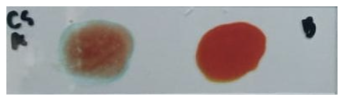 <p>Identify the:</p><ul><li><p>Blood Group</p></li><li><p>Antibody/Antibodies Present</p></li><li><p>Antigen(s) Present</p></li></ul><p></p>