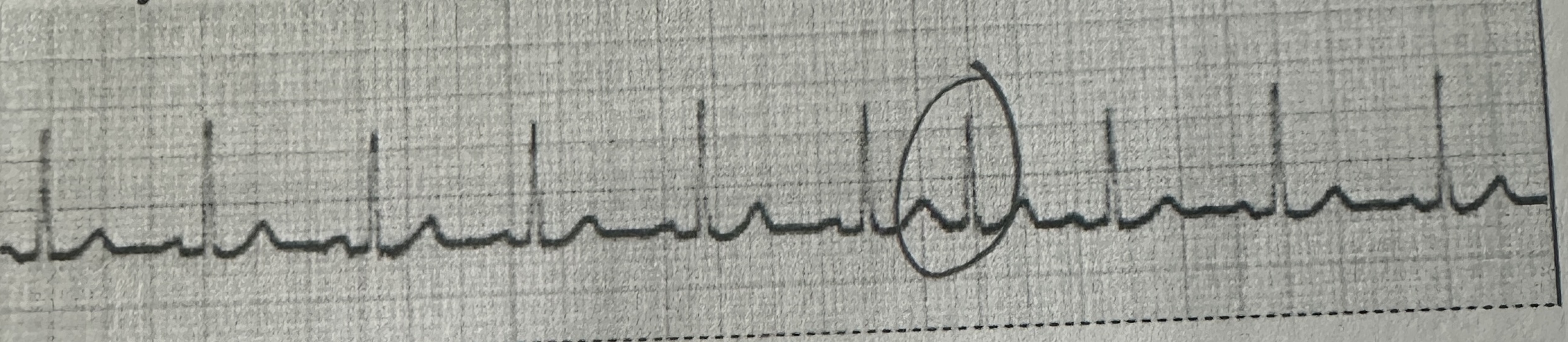<p>identify this rhythm</p>