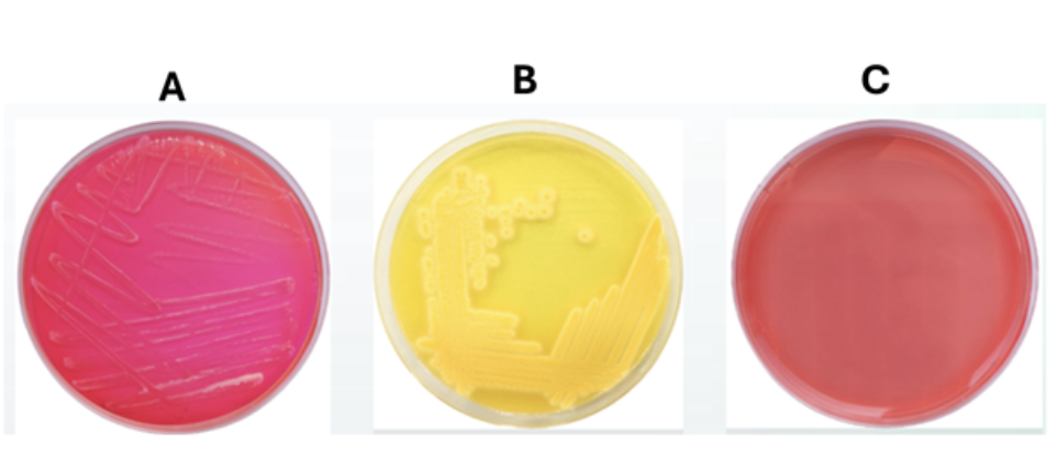 <p>These are the results of three bacterial specimens inoculated on mannitol salt agar (MSA). Which plate(s) has/have bacteria that are halotolerant?</p><ul><li><p>plate A and plate B</p></li><li><p>plate B only</p></li><li><p>plate A and plate C</p></li><li><p>all three plates have halotolerant bacteria</p></li></ul><p></p>