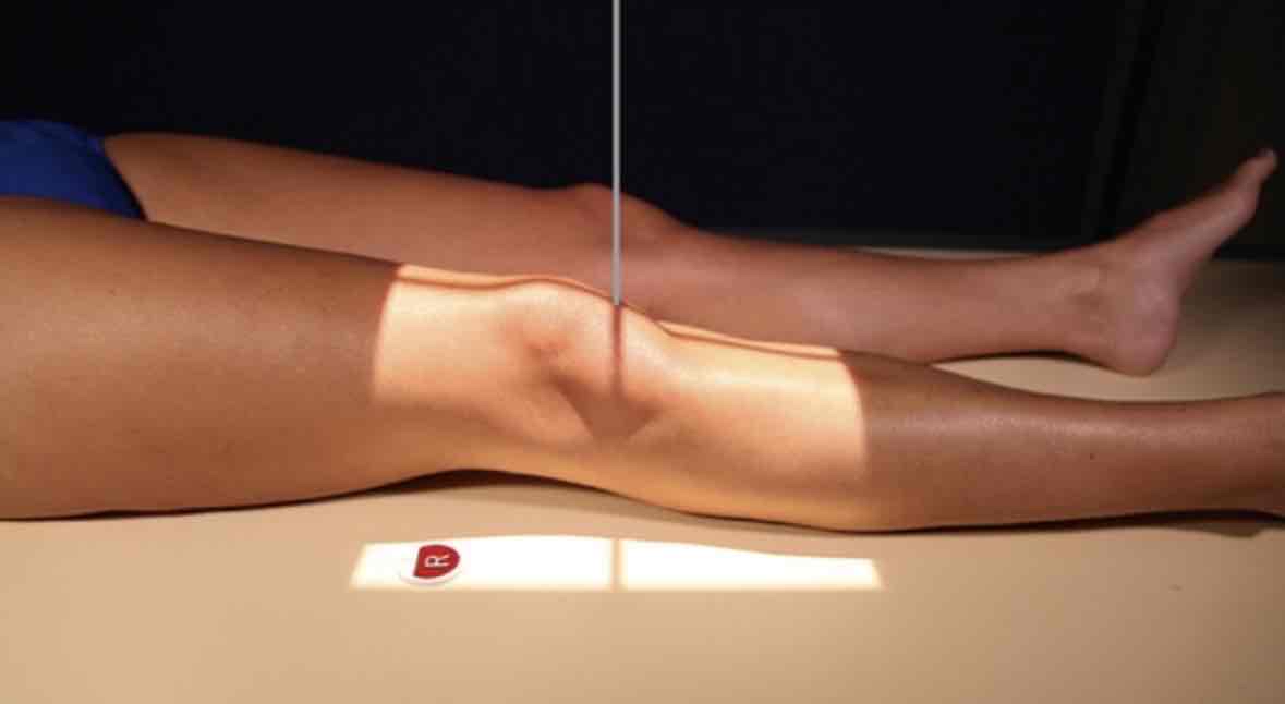 <p>What Projection is this?</p>