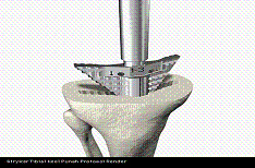 <p><span style="font-family: Lato Extended, Lato, Helvetica Neue, Helvetica, Arial, sans-serif">This picture shows Keel punch.</span></p>