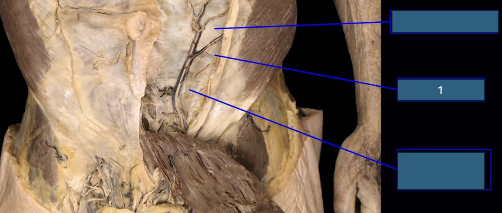 <p>1</p>
