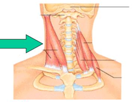 <p>one of the 20 muscles in neck flexes and rotates head</p>