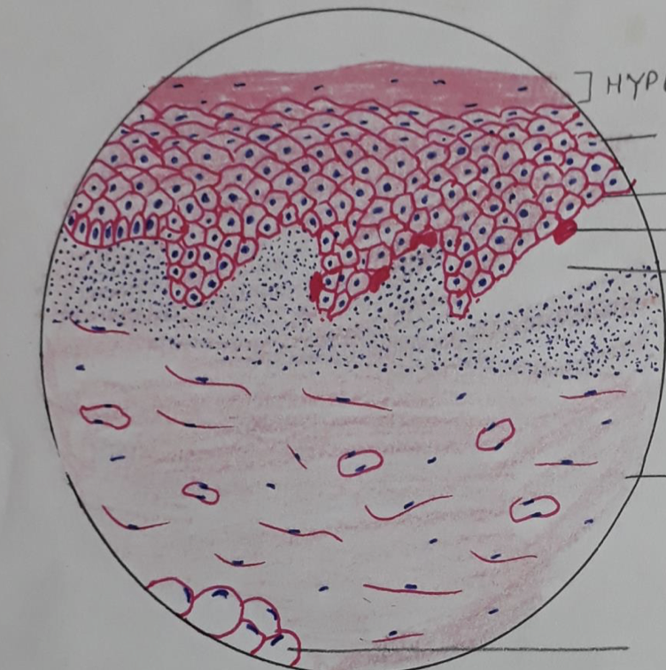 <p>Label from Top to Bottom and Diagnose</p>