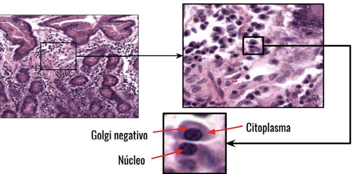 <p>células plasmáticas o plasmocitos</p>
