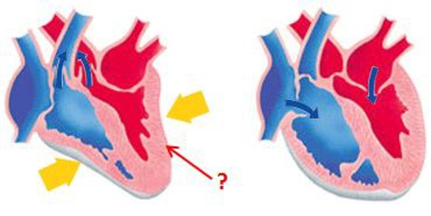 <p>Contraction of the heart</p>
