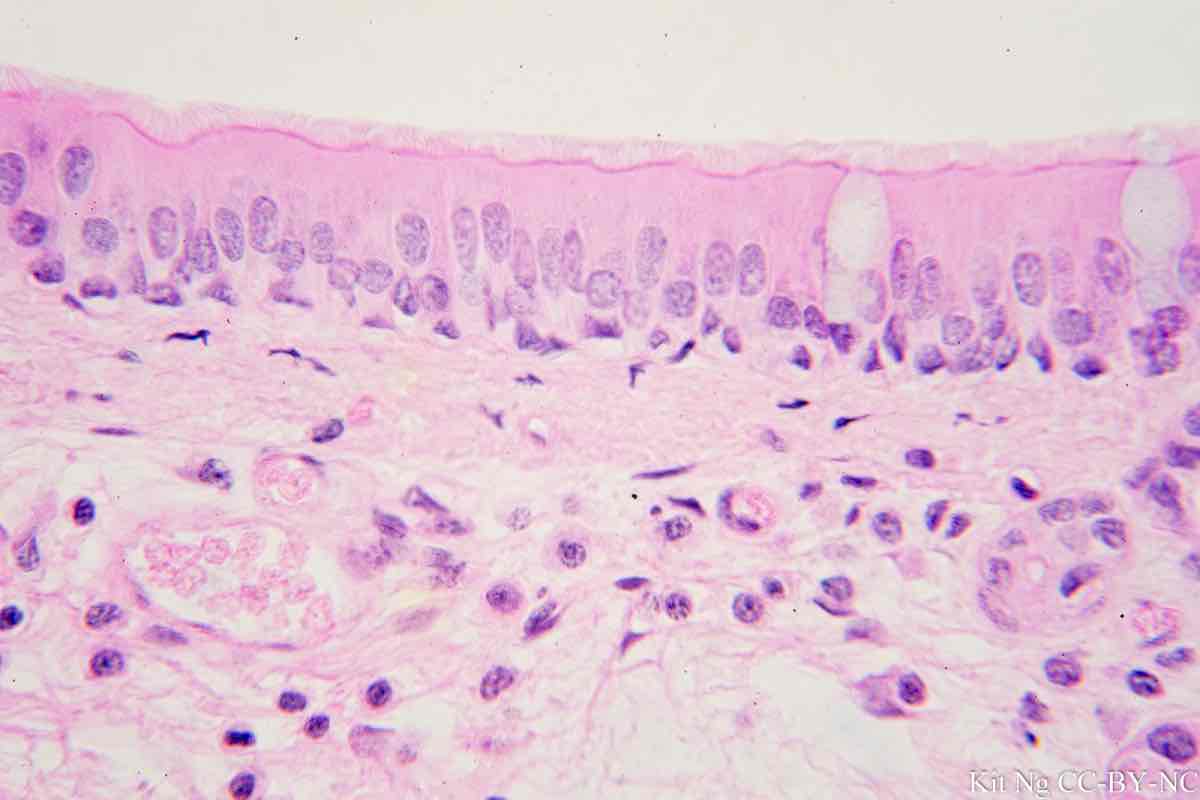 <p>A single layer of cells that appears stratified due to varying cell heights, often ciliated.</p>