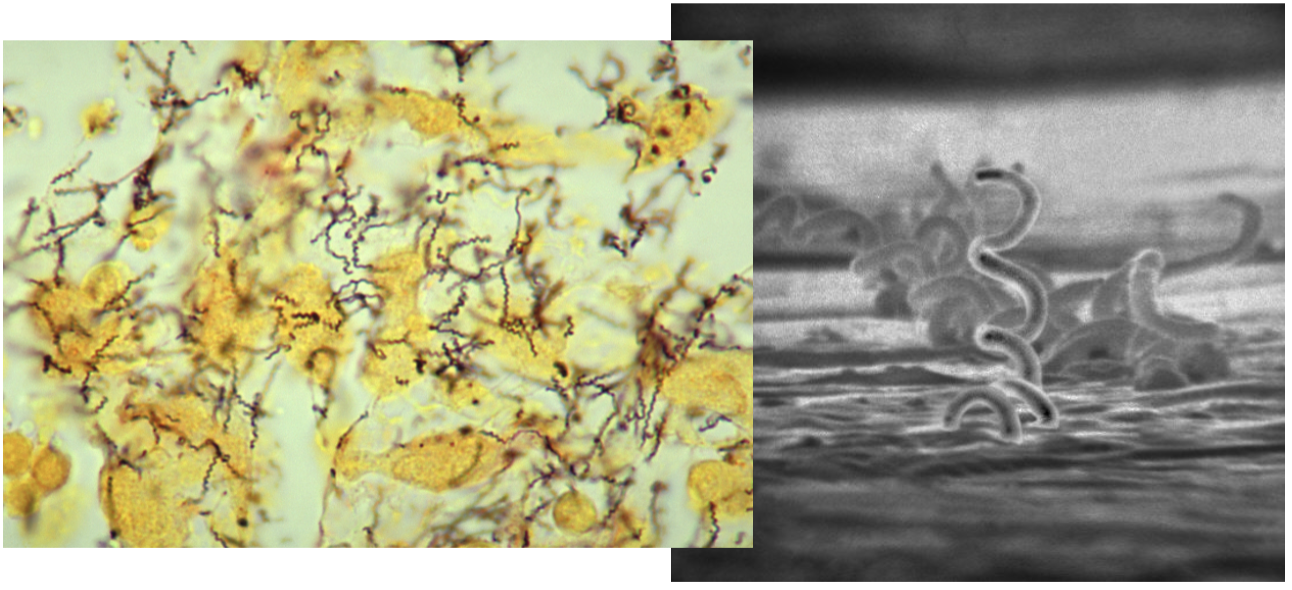 <p>What is this bacteria and what disease does it cause?</p>
