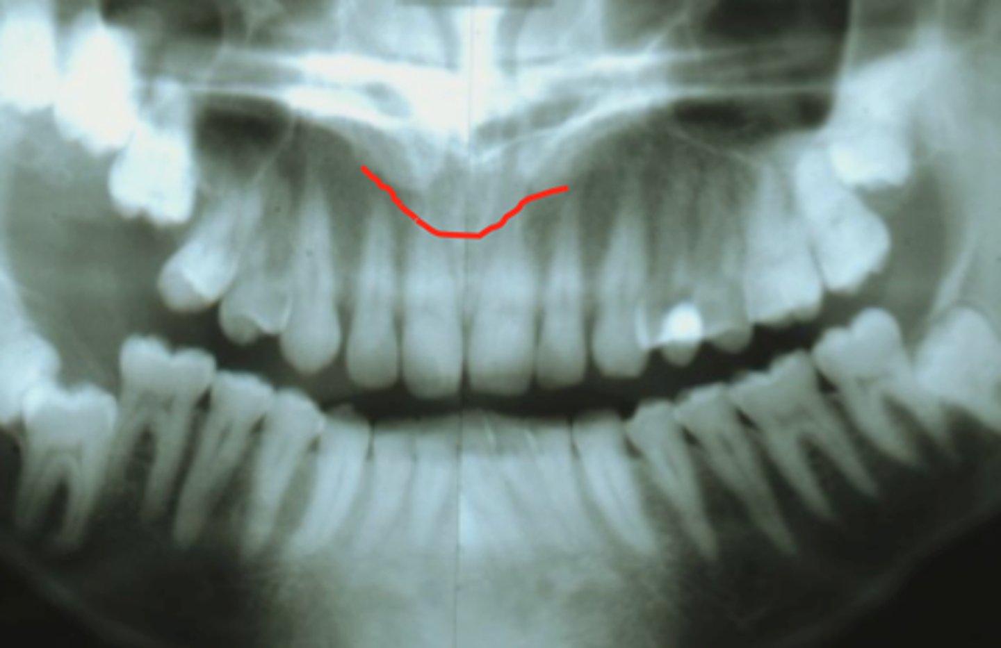 knowt flashcard image