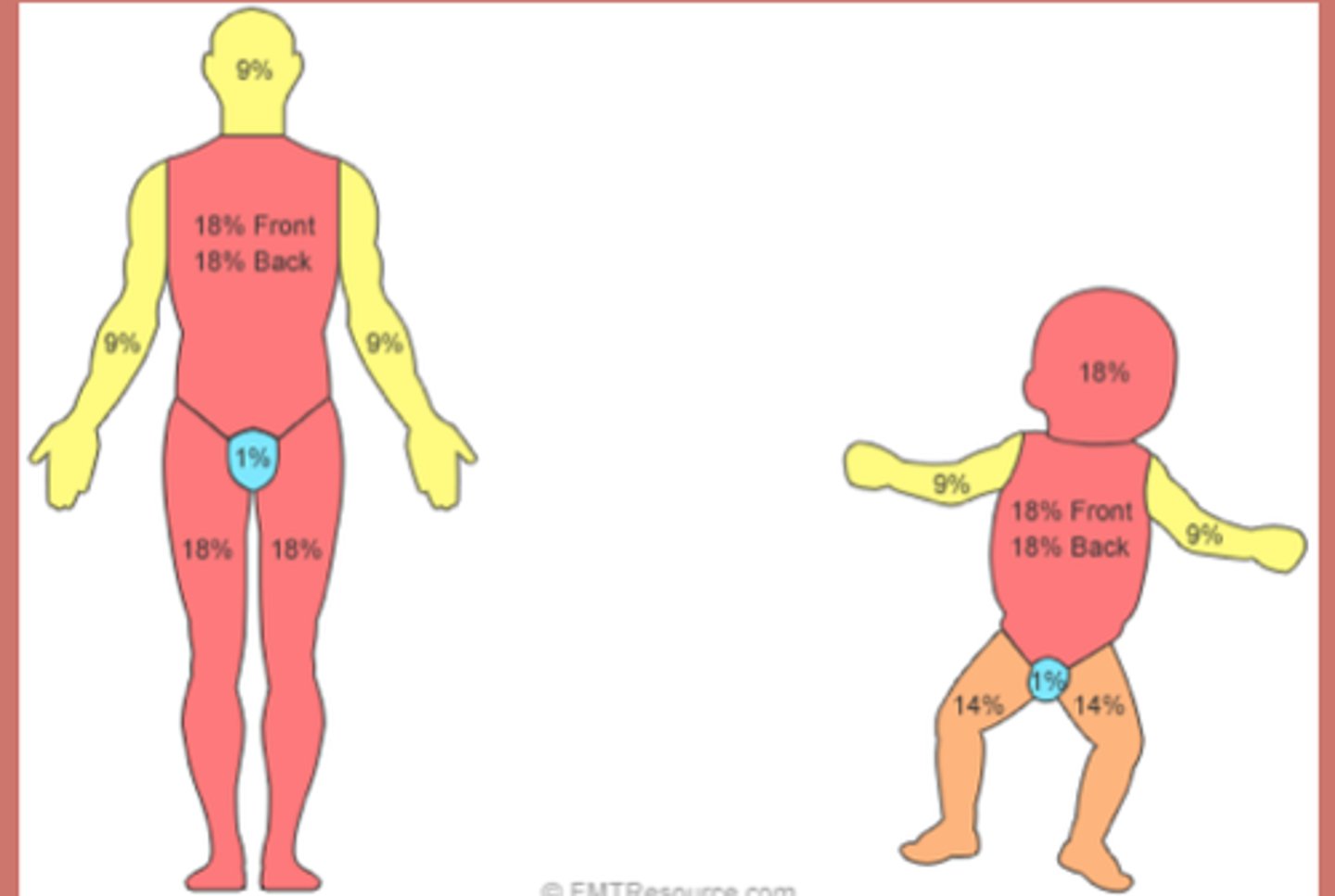 <p>Head and neck = 9%</p><p>Upper Ex = 9% each</p><p>Lower Ex = 9% each</p><p>Front trunk = 18%</p><p>Back trunk = 18%</p><p>Child head = 8.5% (front and back)</p><p>Child arm = 4.5% (front and back)</p><p>Child thorax = 18% (front and back)</p><p>Child legs = 6.5% (front and back)</p><p>The trunk is the only one where we can divide it into upper and lower.</p><p>If they ask about the glutes remember it's with the trunk and not the legs.</p>