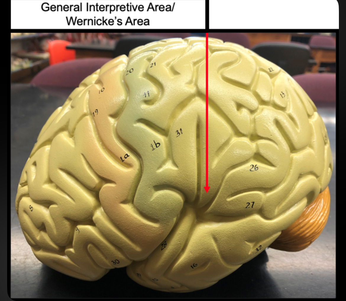 <p>Wernicke’s Area</p>