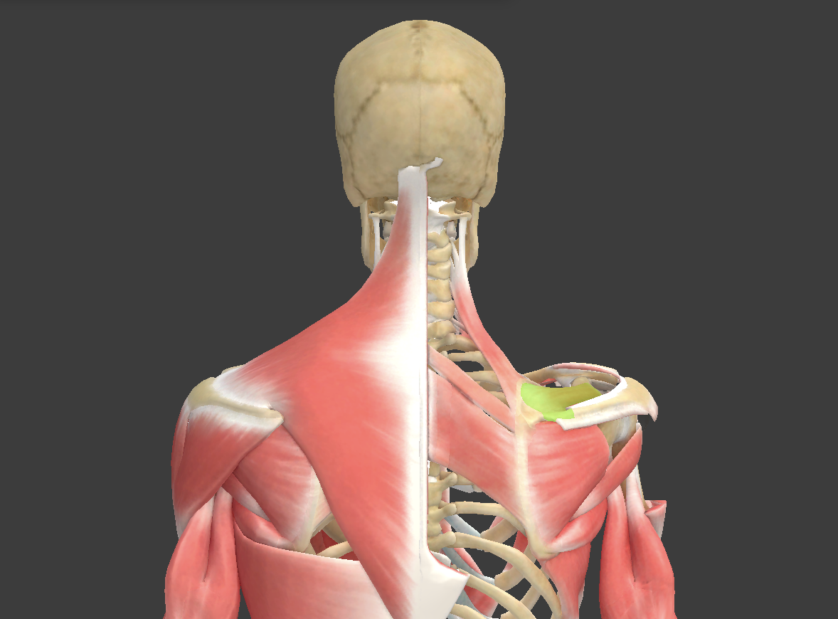 term image