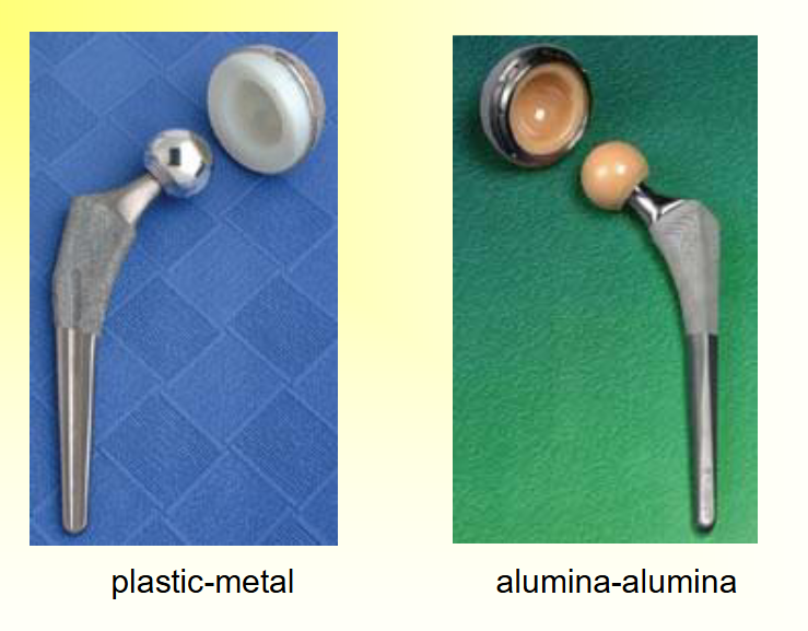 <p><span style="color: rgb(253, 253, 253);">Alumina socket and ball, coefficient of friction decreases with time and approaches&nbsp;the value of a normal joint  wear 10 times slower than metal-PE surfaces</span></p>