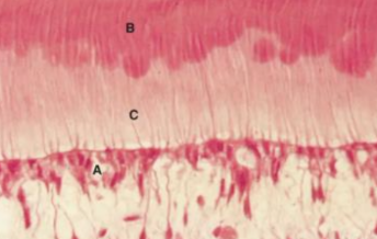 <p><span style="background-color: transparent;"><span>det är det yngsta omineraliserade dentinet och ligger intill pulpan. Den bildas av odontoblaster och mineraliseras successivt för att omvandlas till vanlig dentin.&nbsp;</span></span></p><p></p><p><span style="background-color: transparent;"><span>bild: decalcifierad region: </span></span></p><ul><li><p><span style="background-color: transparent;"><span>A = odontoblastlagret,&nbsp;</span></span></p></li><li><p><span style="background-color: transparent;"><span>B = dentinet (globulärt),&nbsp;</span></span></p></li><li><p><span style="background-color: transparent;"><span>C = predentin</span></span></p></li></ul><p></p>