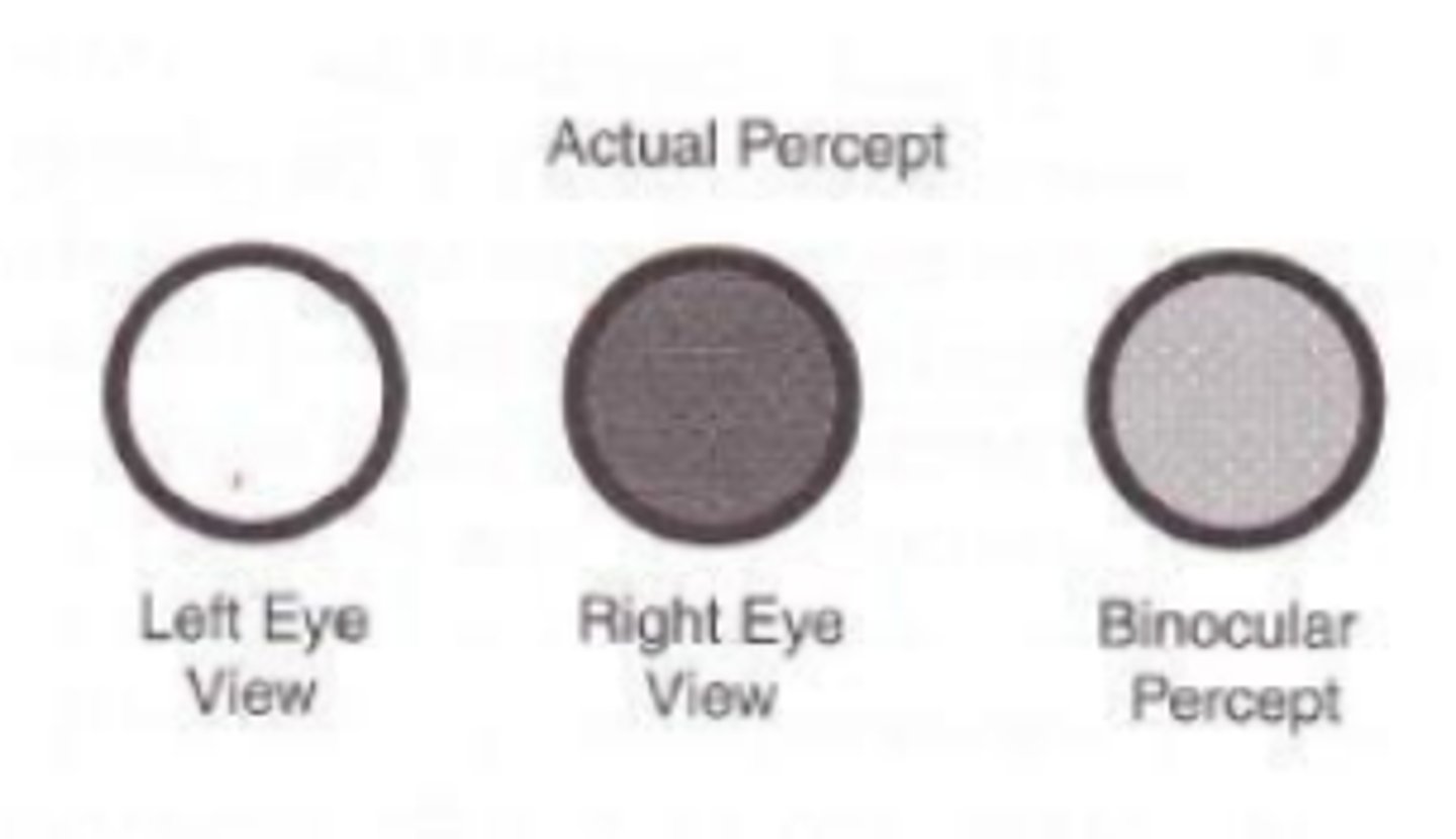 <p>an apparent increase in brightness of a figure caused by the closing of one eye, or decreased brightness upon binocular viewing. Demonstrates binocular brightness averaging where when one eye sees a target as brighter than the other eye, and the binocular image appears less bright with both eyes open.</p>