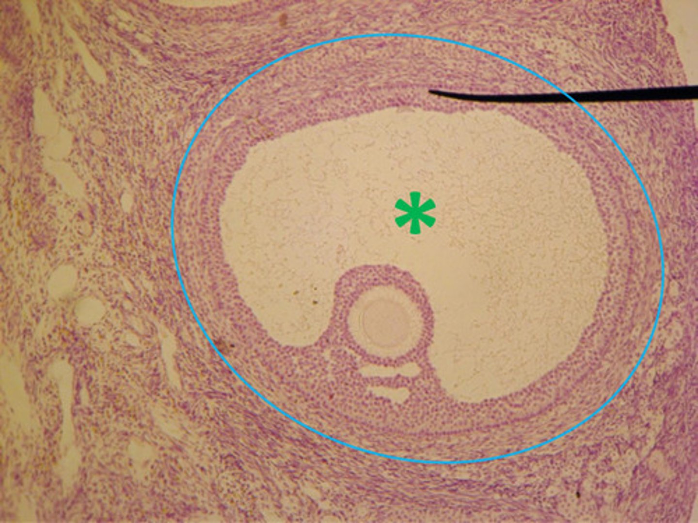 <p>the fluid-filled cavity in the center of the follicle that forms as granulosa cells proliferate</p>