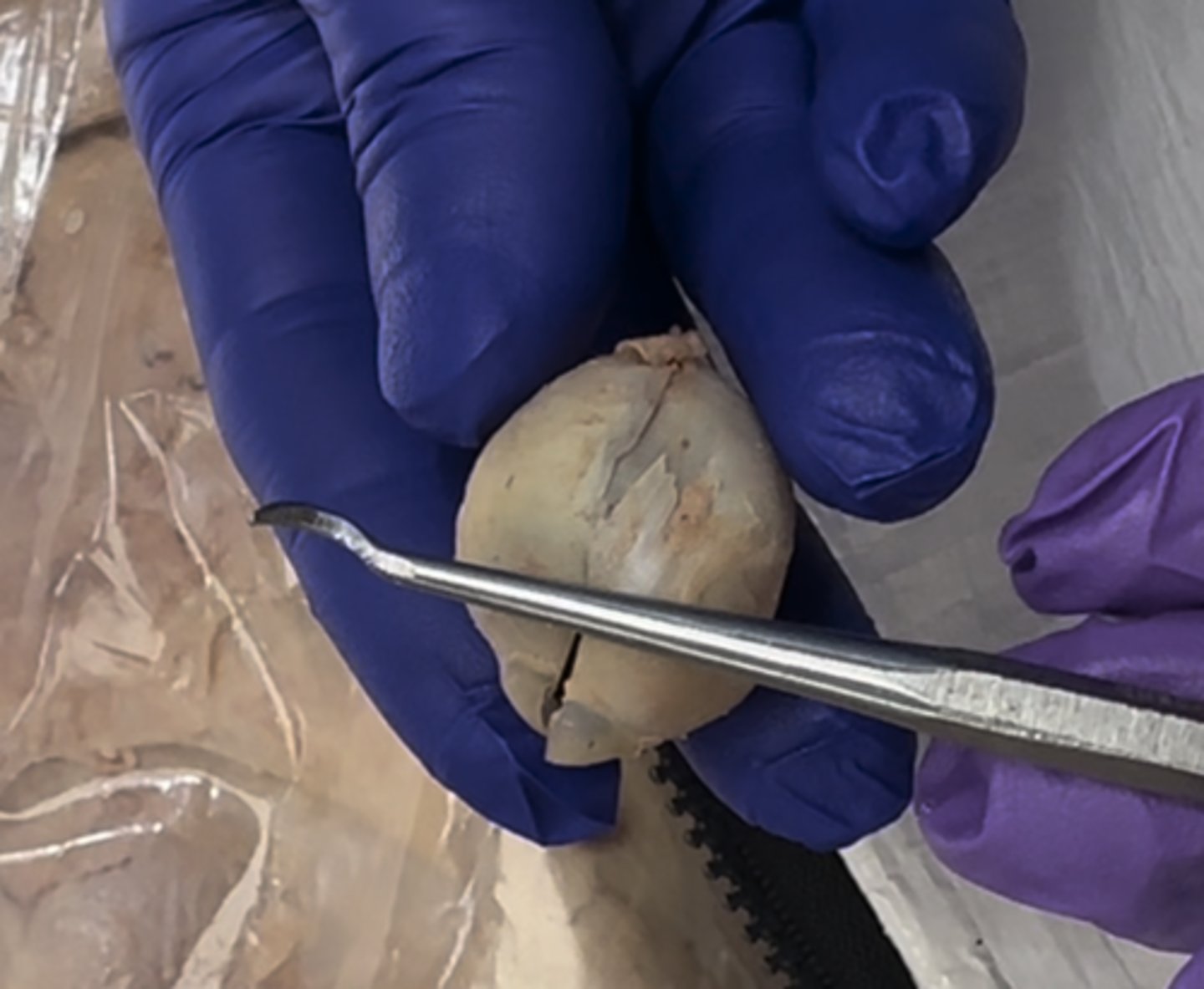 <p>Taking the eye and splitting it into thirds, the lower 2/3 will form the</p>