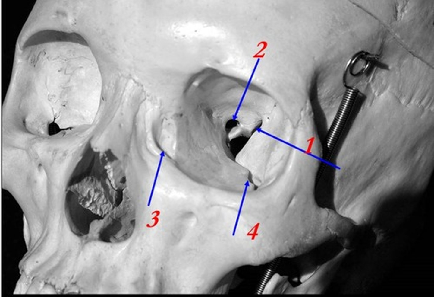 <p>What is #4 pointing to?</p>