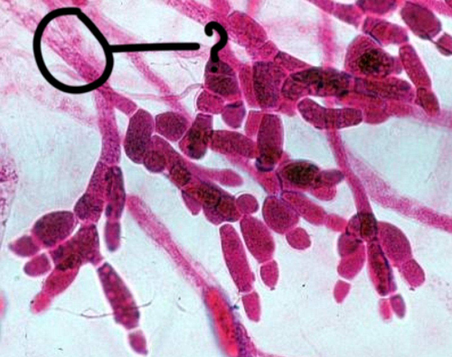 <p>Interconnected network of hyphae</p>