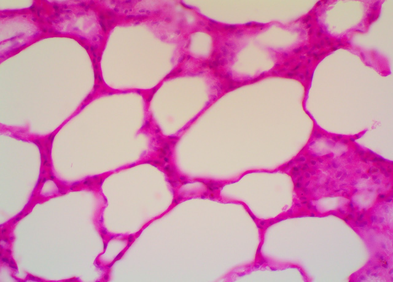 <p><span>Found in blood vessel linings &amp; lung alveoli. Maximizes diffusion because the membrane is thin. </span></p>
