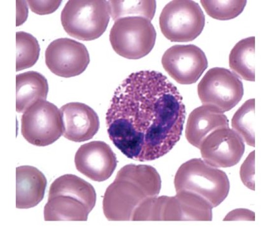 <p>which leukocyte is this?</p>