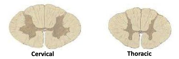 <p>why do the transverse sections of cervical and thoracic spinal cords look so different?</p>