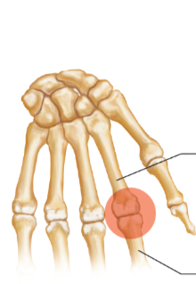 <p>What joint is this an example of? </p>