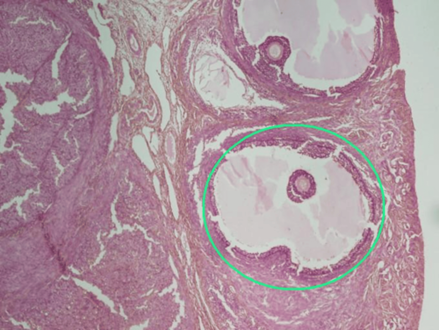 <p>Identify the indicated structure within the ovary.</p>