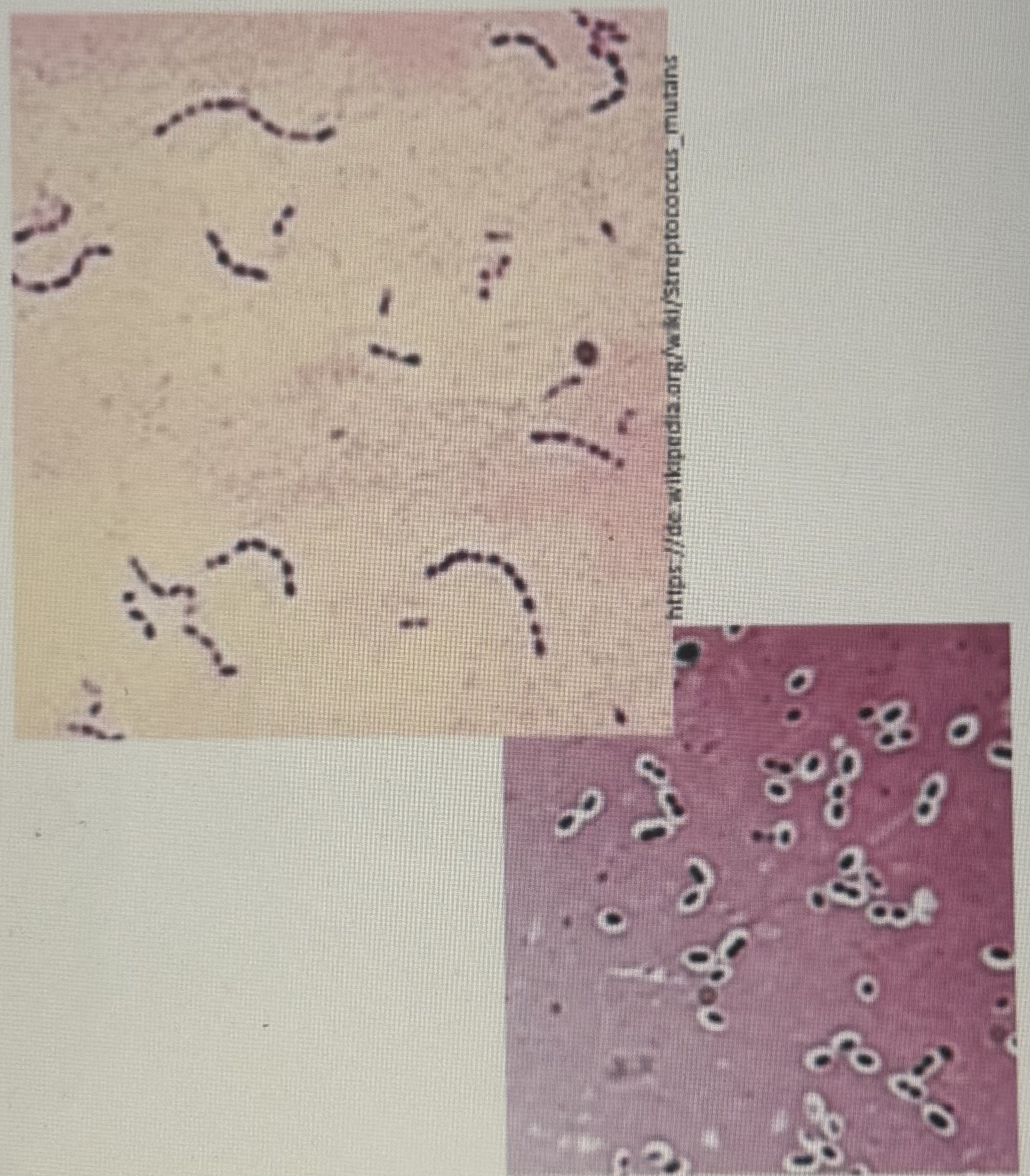 <p>Streptokokken Steckbrief</p>