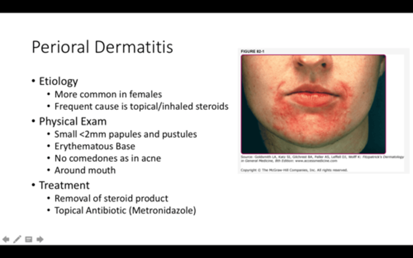 <p>acne-like condition around the moth that may be caused by toothpaste or products used on the face</p>