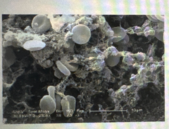 <p>Which of the following microscopes would be used to produce the following image of a blood clot?</p>