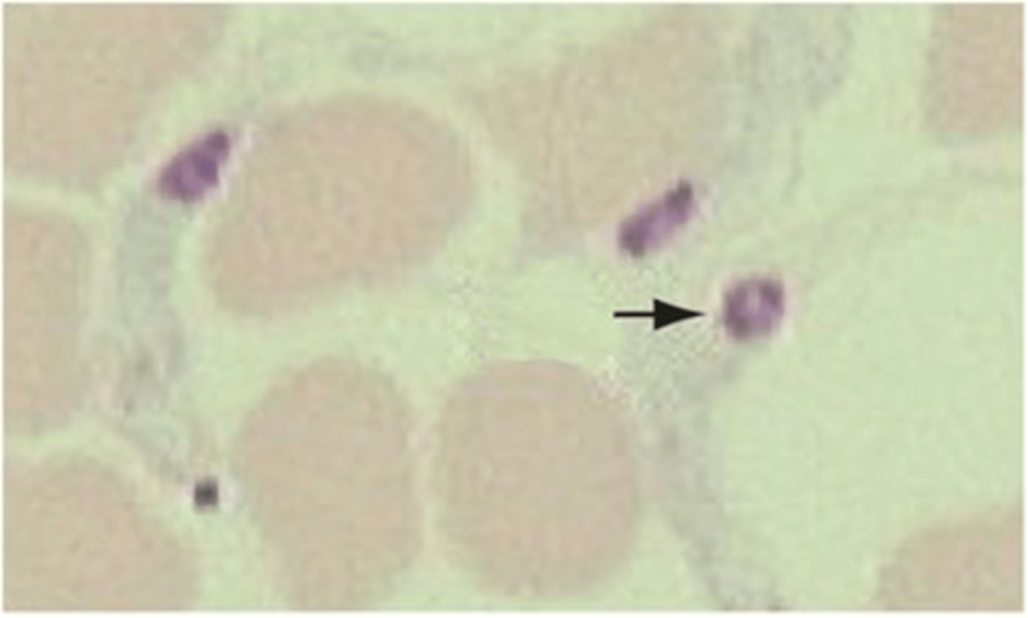<p>These "onion skin" tissue cysts can be found in skeletal muscle of dogs. The parasite</p><p>produces a violent and often fatal course of disease in dogs. It is spread by ticks. What is this</p><p>protozoan of dogs?</p>