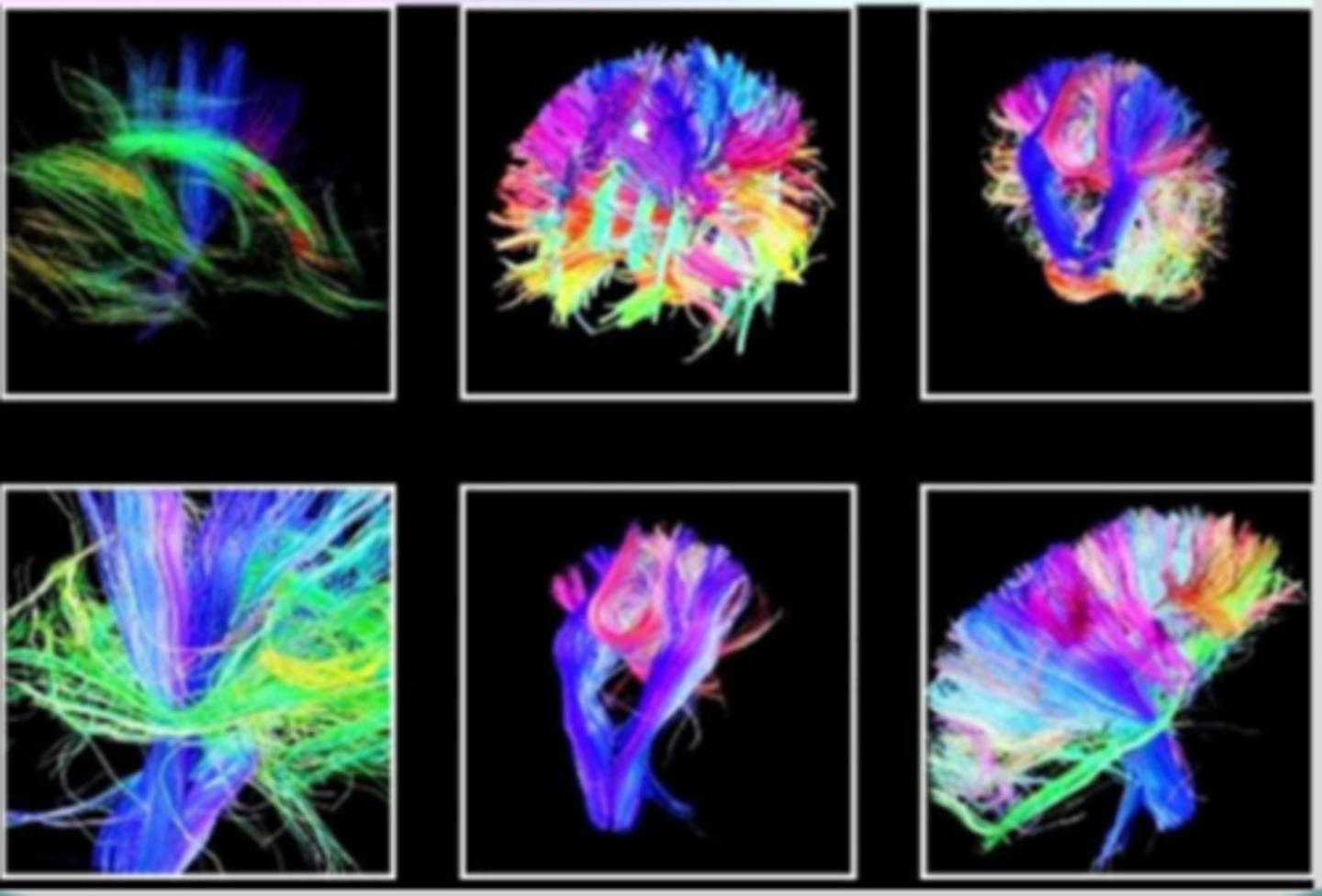 <p>a large-scale, multi-university effort to map the brain's circuits</p>