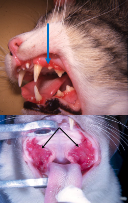 <ul><li><p>raised, erythematous, proliferative lesion<br>-glossopalatine arch<br>-periodontal gingiva </p></li><li><p>idiopathic- hypothosis is inappropriate immune reactions </p></li></ul><p></p>