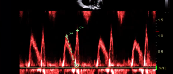 <p>what measurement is this showing </p>