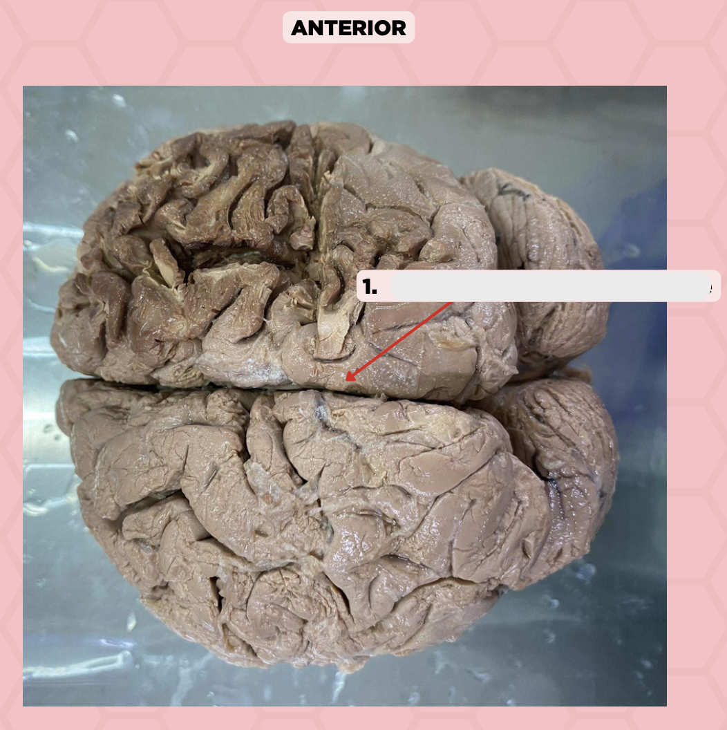 <p>Identify the structure labeled as 1.</p>