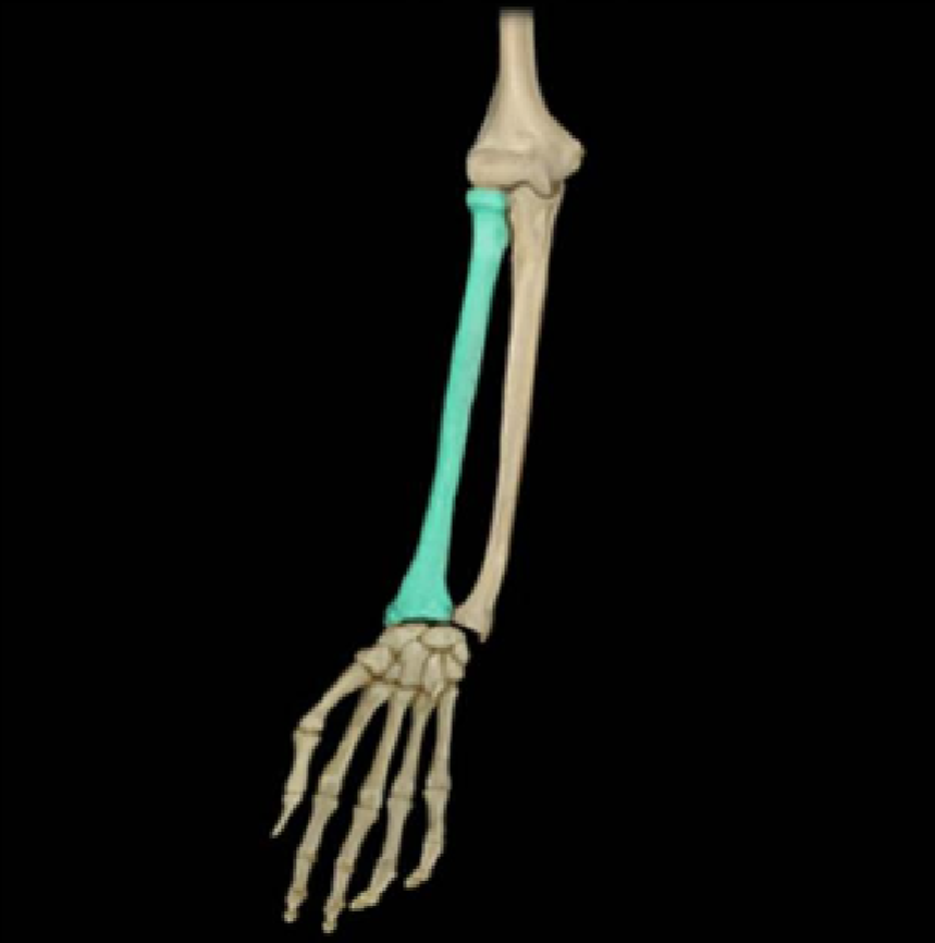 term image