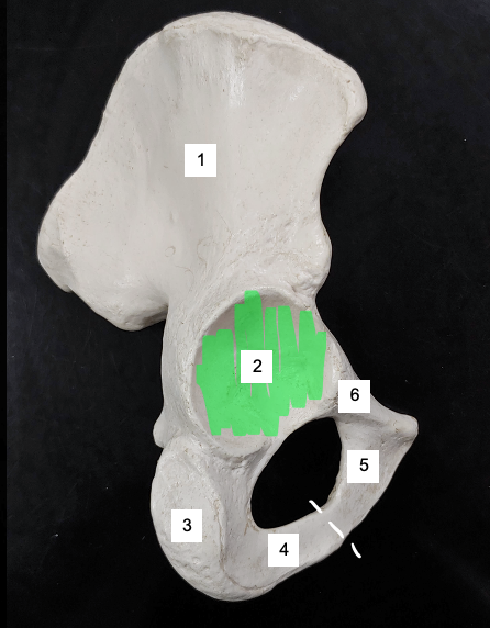 <p>What structure is 3?</p>