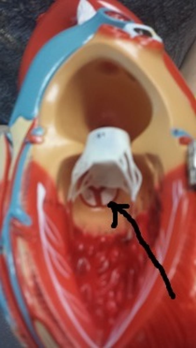 <p>Identify.</p>