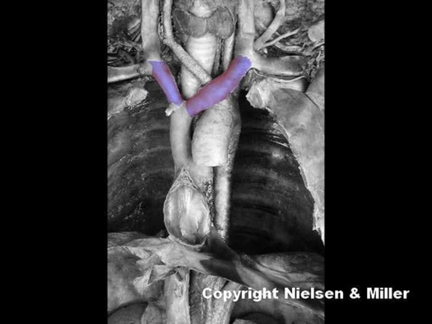 <p>Identify the highlighted vessels.</p>