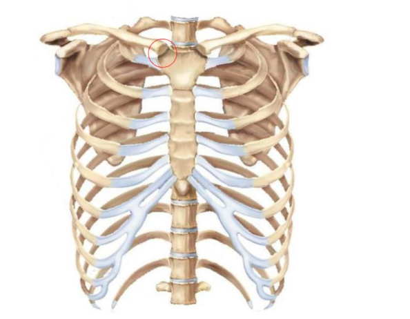 Which joint is indicated in the figure?