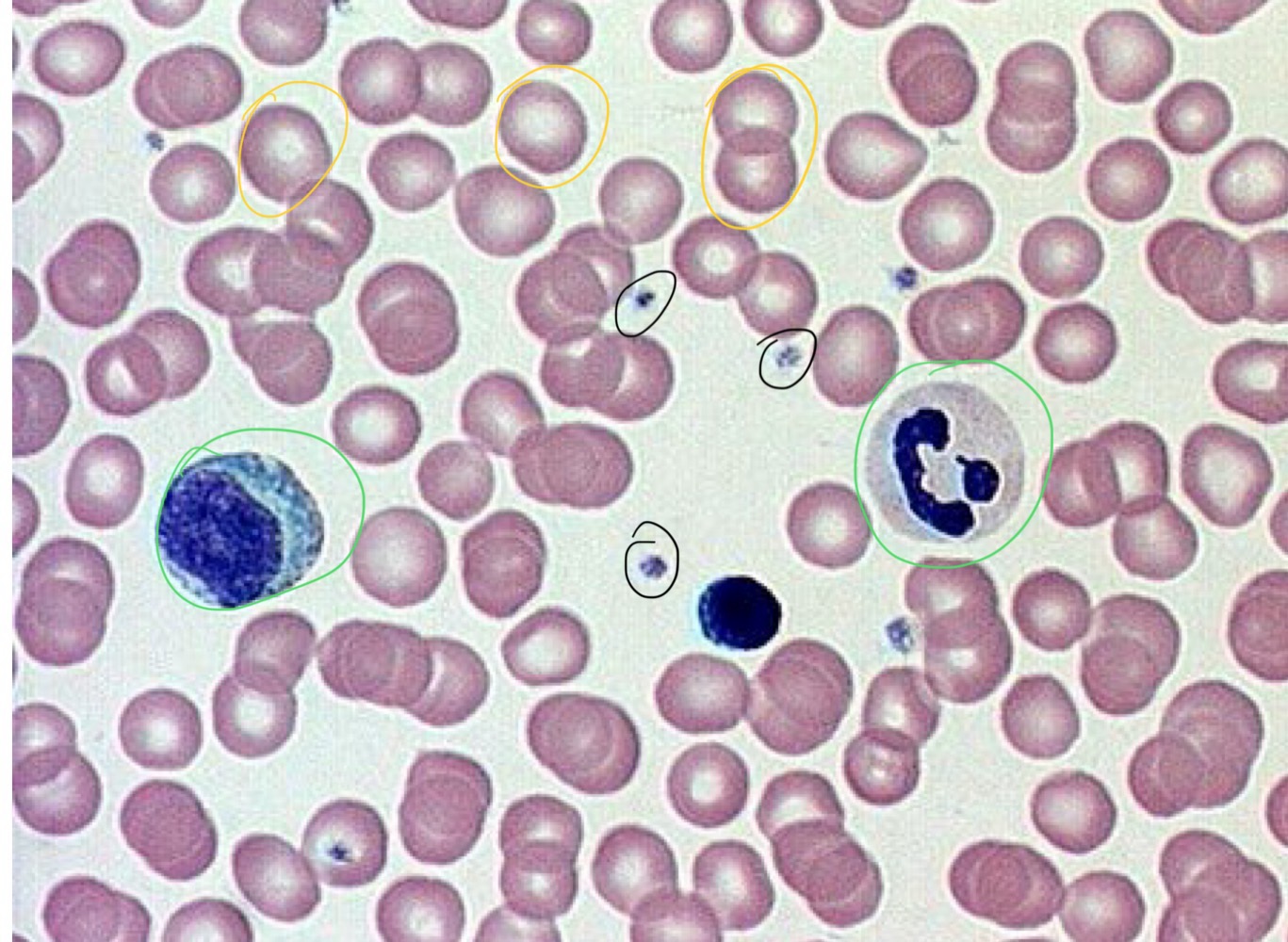 <p>fights infection</p>
