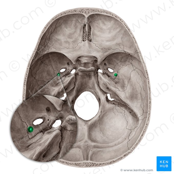 <p>Which bone landmark of the skull is a small hole lateral to ovale?</p>