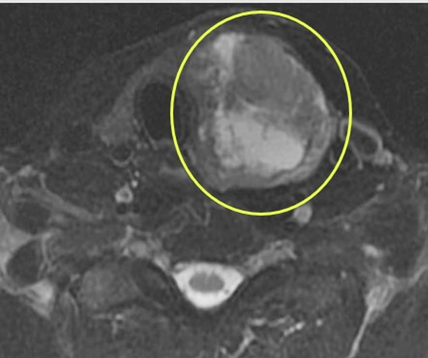 <p>Label pathology in image below</p>