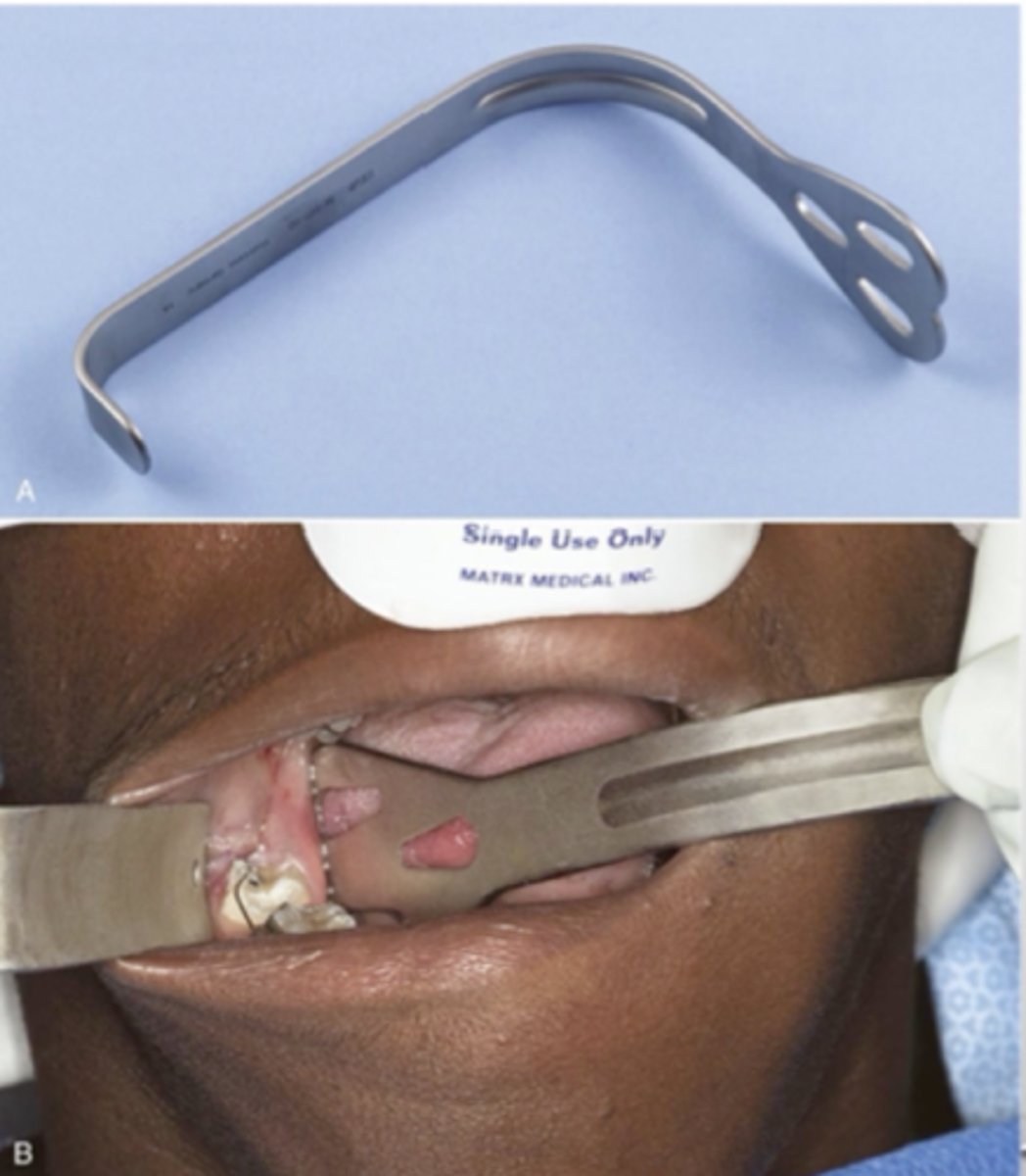 <p>_________ retractor is pictured </p><p>- used to retract the tongue</p>