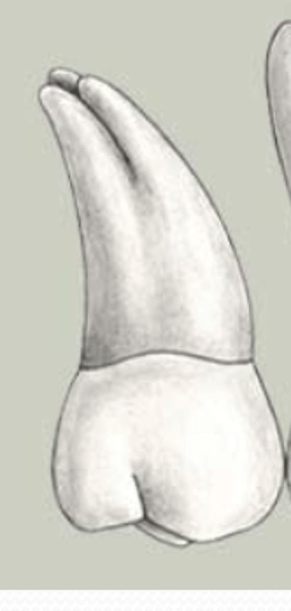 <p>roots flare distally and are fused together</p>