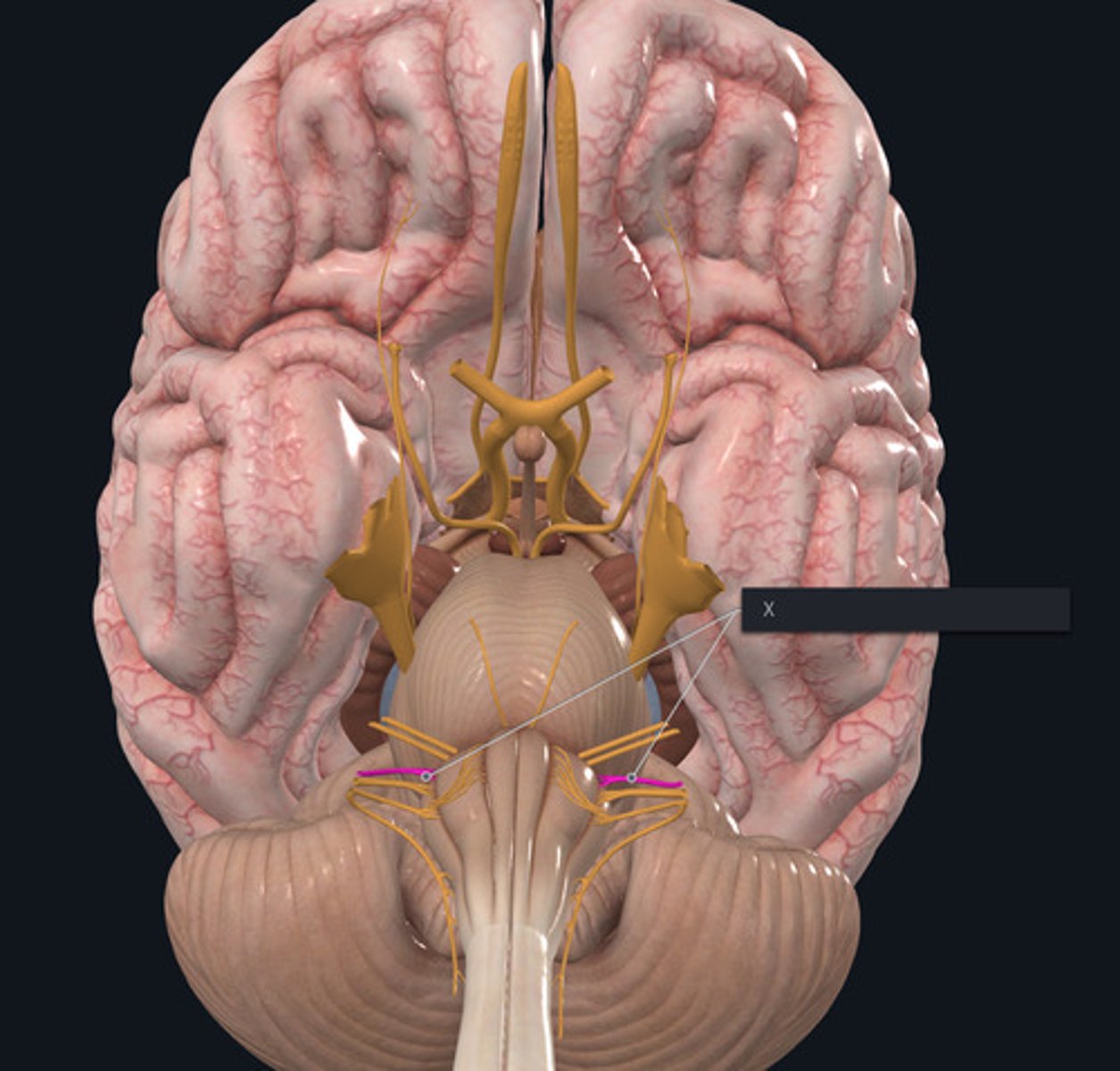 <p>Name the Nerve highlighted purple and indicated by the X.</p>