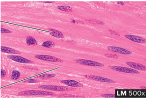 <p>what type of muscle is this</p>